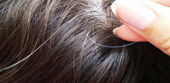 Почему возникают седые волосы